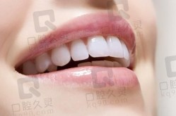 皓齿美白牙齿的价格和效果如何？