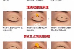 做双眼皮手术哪最好？如何选择合适的手术方法？