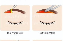 种眉毛要多少钱？全过程是怎样的？