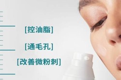 雅漾去红血丝有效吗？敏感肌能用吗？