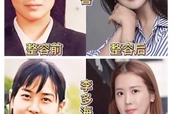 去韩国整形需要多少钱？和国内相比有什么优势？