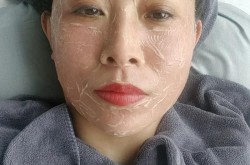 细胞美容技术靠谱吗？细胞美容有哪些风险和副作用？