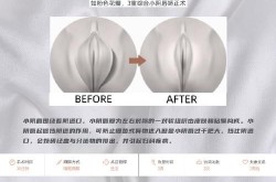 女性私密手术有哪些？如何选择专业的医院和医生？