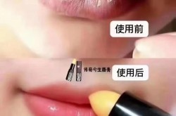 嘴唇干怎么办？有哪些天然方法可以改善嘴唇干燥？