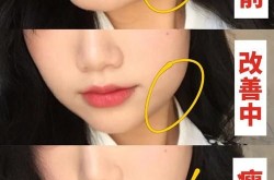 怎样可以瘦脸快速且自然？求方法分享！