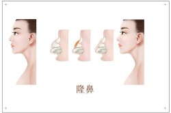 鼻子整形风险大吗？如何降低鼻部整形的风险？
