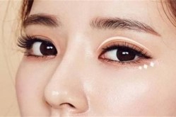 韩式双眼皮美容术和传统方法有何不同？