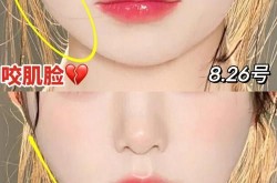 如何瘦咬肌才能不反弹？有哪些有效方法？