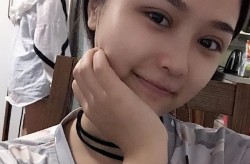 缝双眼皮手术的价格和恢复时间是多久？