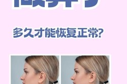 做整形手术会痛吗？有没有缓解方法？
