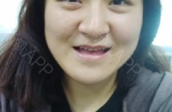长沙科颜美整形医院可靠吗？有哪些成功的案例？