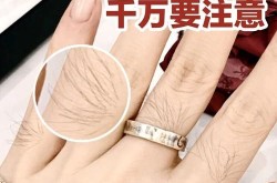 美容绝毛哪种方式最好？有没有永久绝毛的方法？