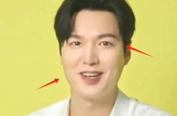 李敏镐整容前后变化大吗？韩国整形有哪些风险？