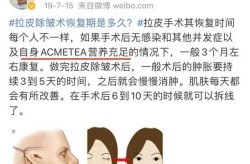 筋膜悬吊术的价格大概是多少？效果怎么样？