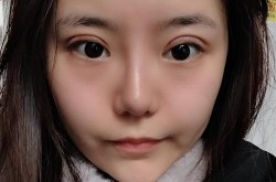 美己整形网上的信息可靠吗？有没有成功案例？
