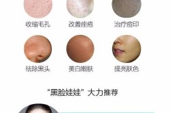 黑脸娃娃美容项目痛不痛，效果怎么样？