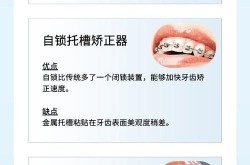 牙齿矫正的价格范围是多少？哪种方法最好？