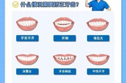 牙齿矫正过程需要注意什么？如何保持口腔卫生？