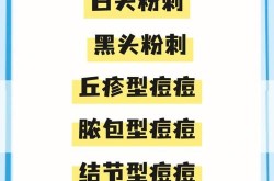 粉刺图片对照表，如何判断自己的粉刺类型？
