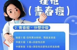 治疗痤疮医院哪家强？求有效的治疗方法！
