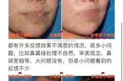 假体隆鼻整形价格受哪些因素影响？