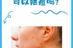 土豆美容护肤小窍门有哪些？真的有效果吗？