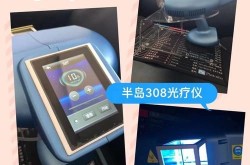 308准分子激光治疗白癜风效果如何？