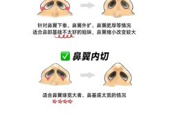 鼻头缩小手术的价格是多少？恢复期需要注意什么？