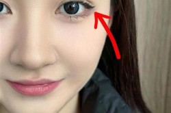 宁波美莱整形医院割双眼皮效果好不好？价格公道吗？