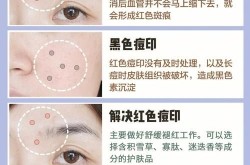 去痘印要多少钱？去痘印的有效方法有哪些？