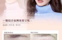 韩式双眼皮整形医院哪家案例更成功？参考案例有哪些？