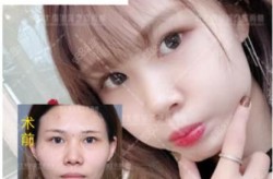 北京基础美整形技术怎么样？有哪些成功的案例？