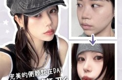鼻部整容整形手术有哪些类型？