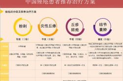 痤疮手术治疗后会不会复发？如何避免？