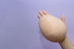 隆胸手术要花多少钱？哪些因素影响价格？
