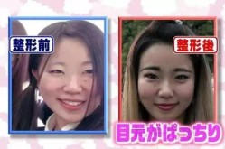 日本整容技术有哪些特点？与国内整容的区别？