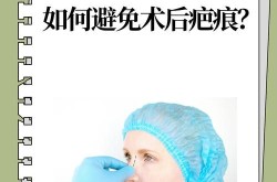 大鼻子整形手术安全吗？术后怎样护理？