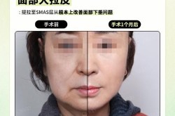 韩国首尔整形医院哪家好？价格和手术效果怎样？