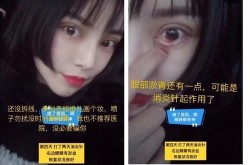 拉双眼皮手术疼吗？恢复期需要注意什么？