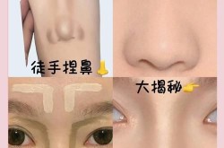 塌鼻梁怎么变高？有哪些鼻部整形方法？