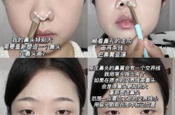 整容鼻子需要多少钱？鼻整形有哪些常见风险？