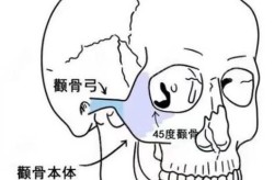 颧骨整形手术风险大吗？如何避免？