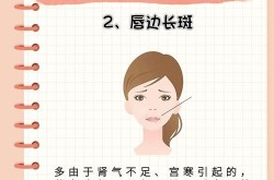 点雀斑多少钱？点雀斑后如何护理？