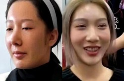 都美竹整容前照片和现在变化大吗？她的整形经历公开了吗？