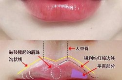 丰唇整形有哪些方法？效果和安全性如何？