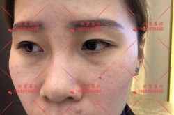 天大整形医院口碑如何？真实案例分享！