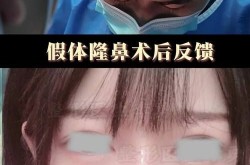 隆鼻整形风险大吗？如何避免手术失败？