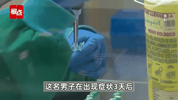意大利男子同时感染猴痘新冠与艾滋(猴痘和艾滋病有关系吗)